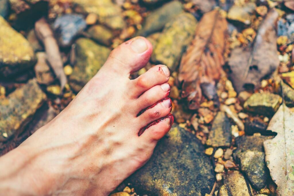 Blood flowing to the feet, From being bitten by leeches attack, Blood Sucking Leech